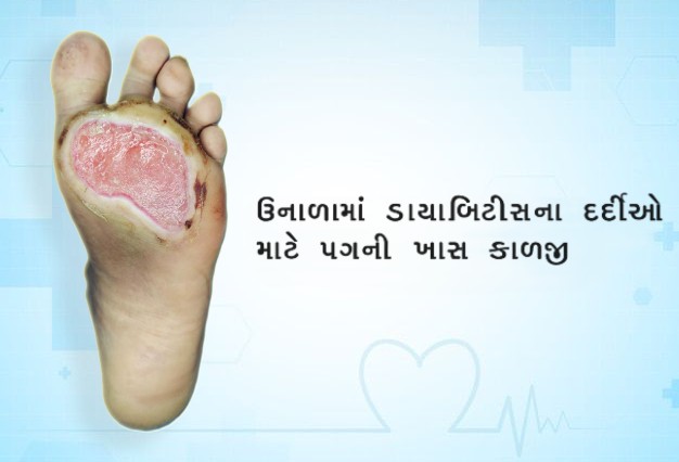 ઉનાળામાં ડાયાબિટીસના દર્દીઓ માટે પગની ખાસ કાળજી